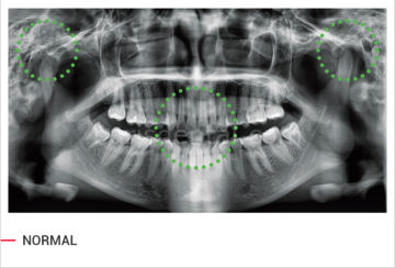Vatech PAX-İ3D Green Volumetrik Tomografi, Dijital Panoramik ve Sefalometrik Görüntüleme Cihazı