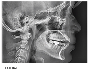 Vatech PAX-İ3D Green Volumetrik Tomografi, Dijital Panoramik ve Sefalometrik Görüntüleme Cihazı