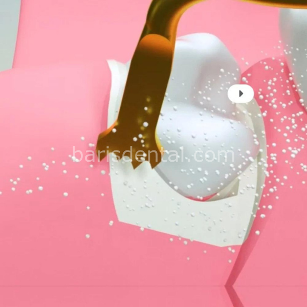 Woodpecker DTE Surgery X Kemik Kesme -Sinüs Lifting Cihazı