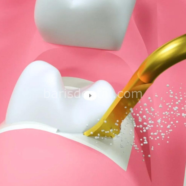 Woodpecker DTE Surgery X Kemik Kesme -Sinüs Lifting Cihazı