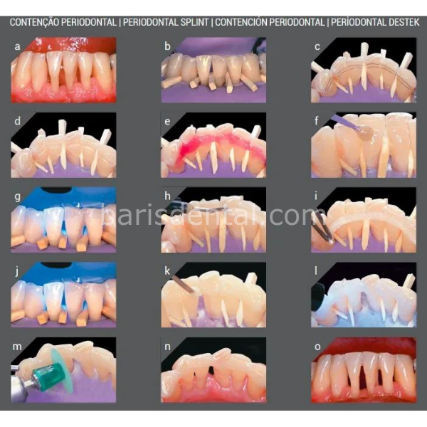 Angelus İnterlig Tek Hasta Stripi 3lük