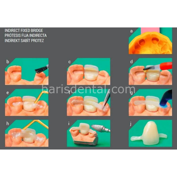 Angelus İnterlig Tek Hasta Stripi 3lük