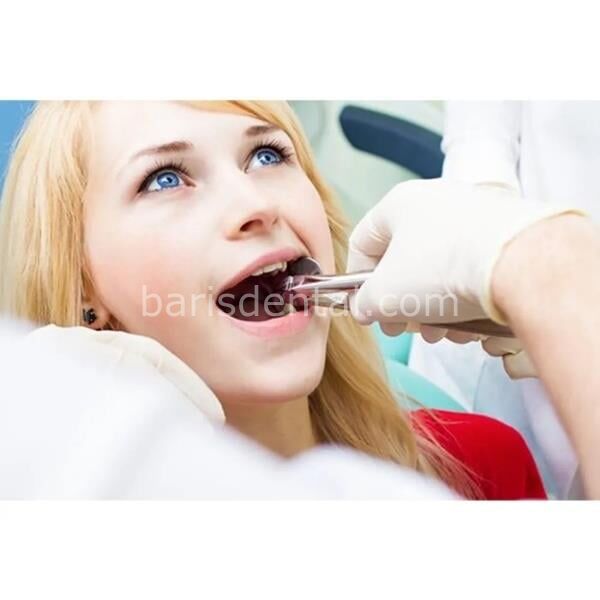 Legend Plus Alt Kökler Azı Çekim Davyesi (Fig.38)