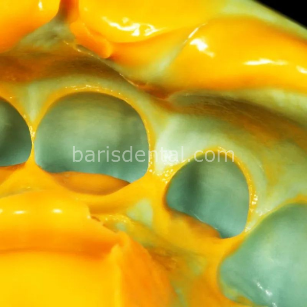 Zhermack Takım için Oranwash (140 ml) 2. Ölçü