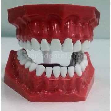 İntegra Çene Modeli