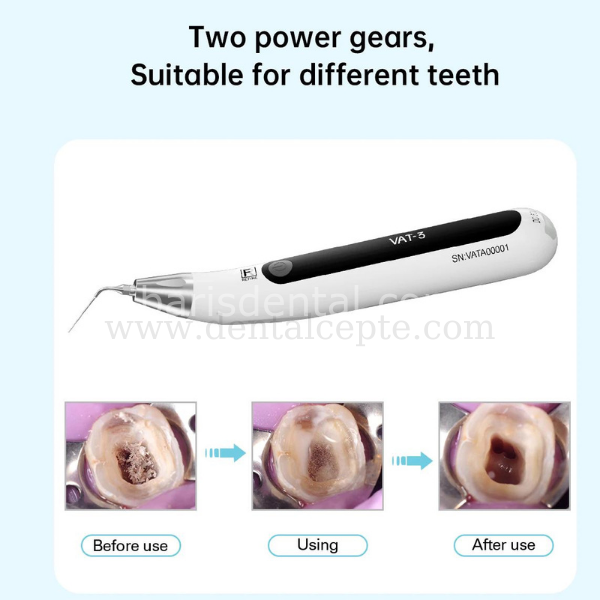 Refine VAT-3 Endo Aktivatör