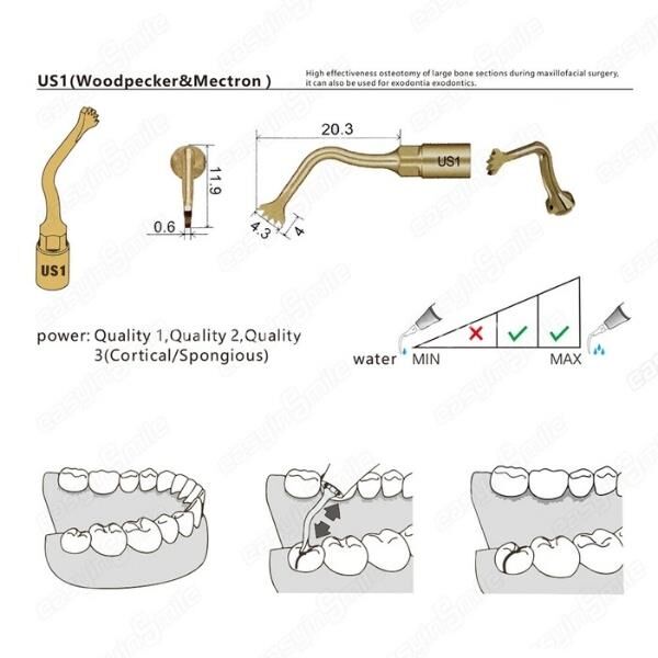 Woodpecker US1 Ultrasurgery Kemik Kesme Ucu