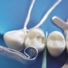 Şeffaf Klipsli Matris Bandı