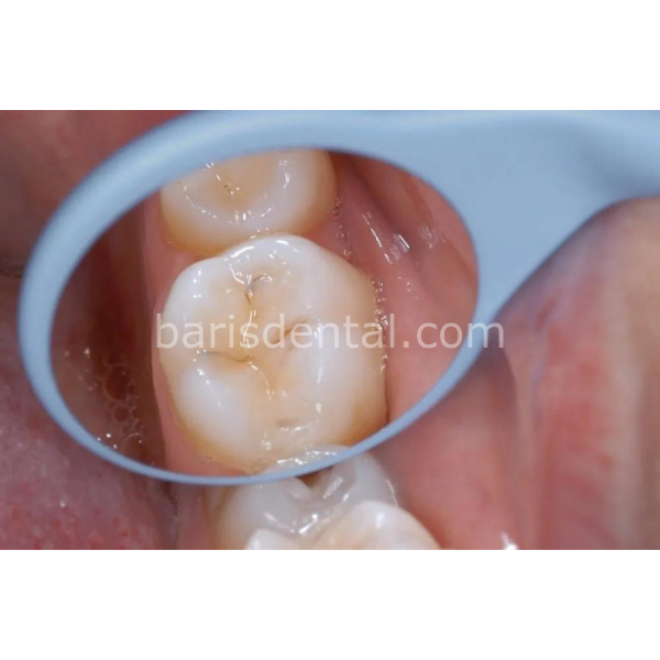 Relax Rodyum Ayna 1 Adet