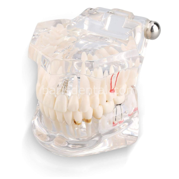 Diş Çene Modeli- Fonksiyonel şeffaf-Hastaları bilgilendirmek için