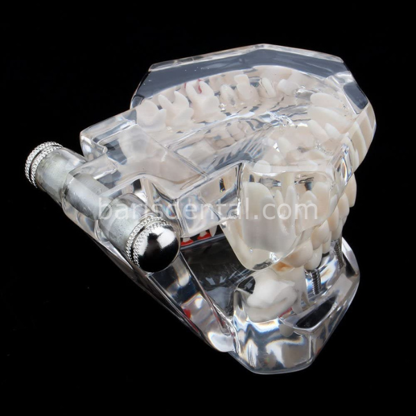 Diş Çene Modeli- Fonksiyonel şeffaf-Hastaları bilgilendirmek için