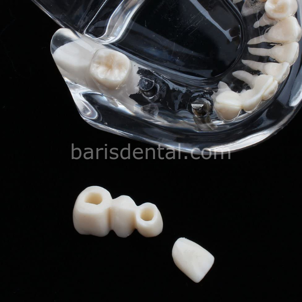 Diş Çene Modeli- Fonksiyonel şeffaf-Hastaları bilgilendirmek için