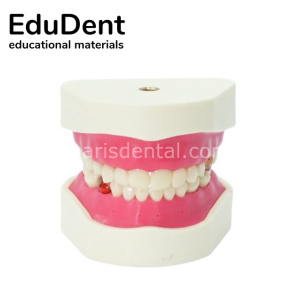 Edudent PedoPrep Alt ve Üst Çene