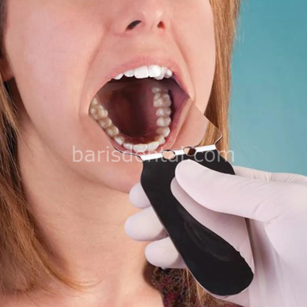 Dental Fotoğraf Aynası Metal Model-2