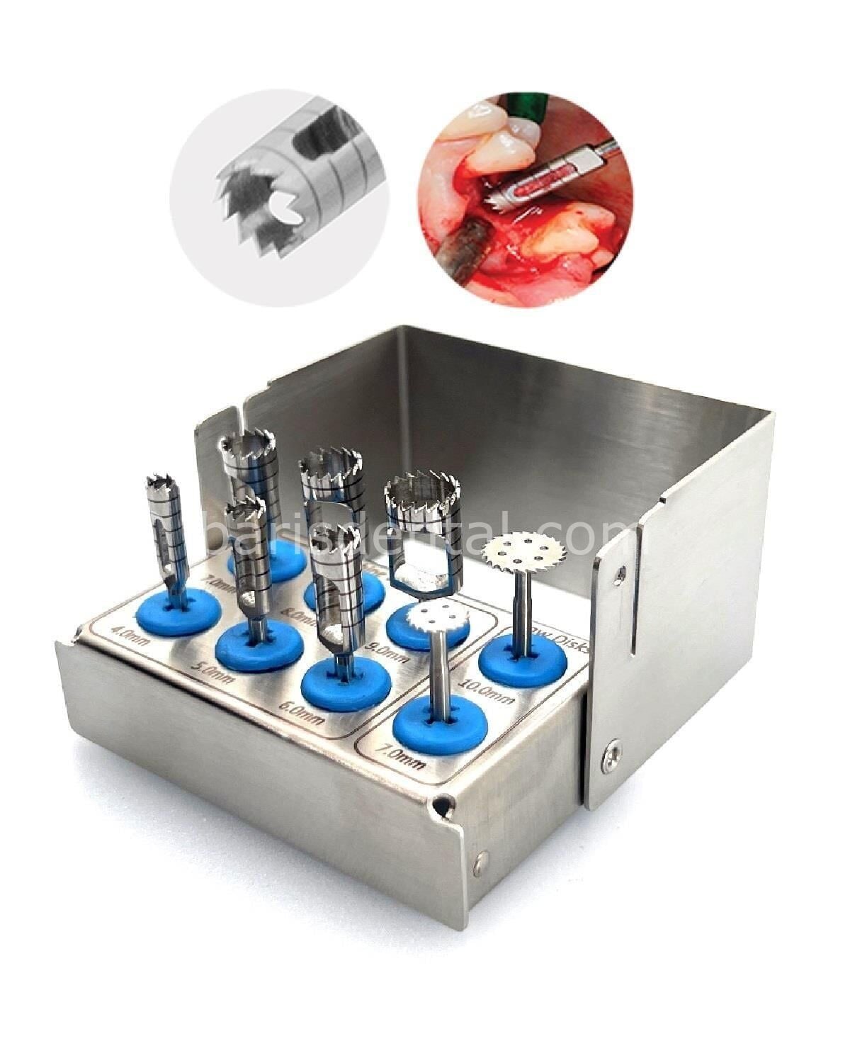 Queen Trefan Frez 2 8cm 8 Ad--Kaset - QSET8TRPH003