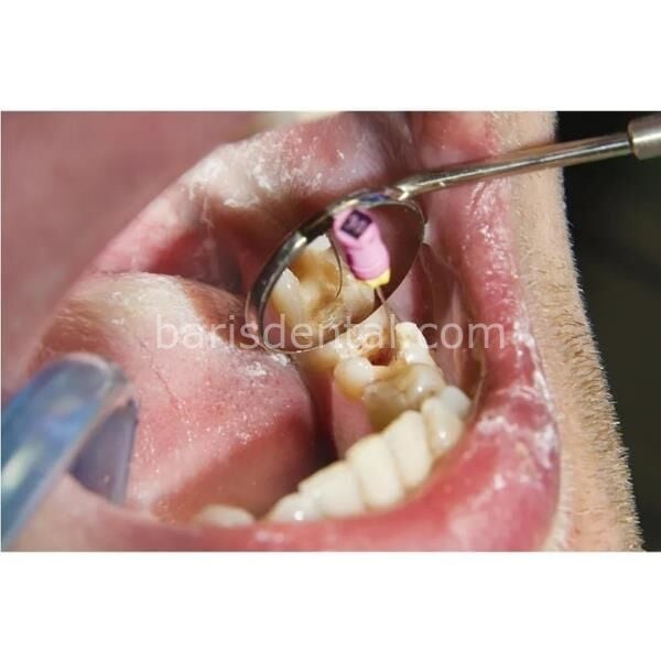 Kruger Ayna Başı 12 li Paket