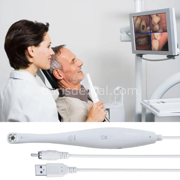 Dental Ağız İçi Kamera + Ekran Seti