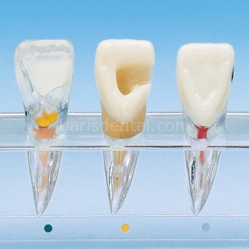 Hasta Eğitim Modeli/Endodonti