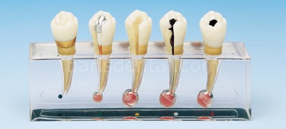 Hasta Eğitim Modeli /Lezyonlu