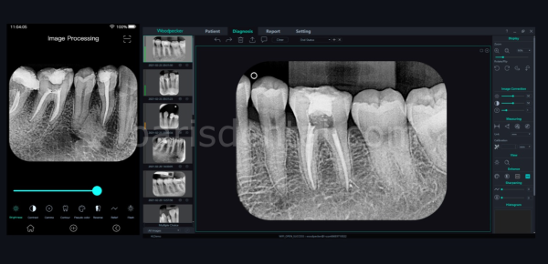 Woodpecker Aİ Scan Fosfor Plak Tarayıcısı
