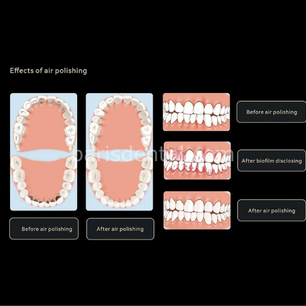 Woodpecker DTE Ap H Airflow Cihazı