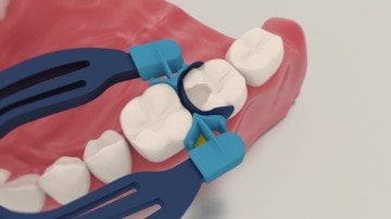 MyClip Bölümlü Matris