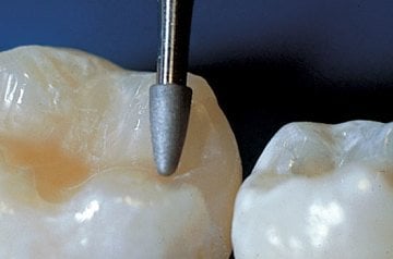 Kompozit Cila Frez Seti