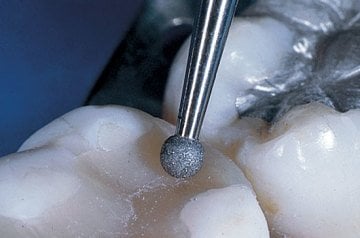 Kompozit Cila Frez Seti