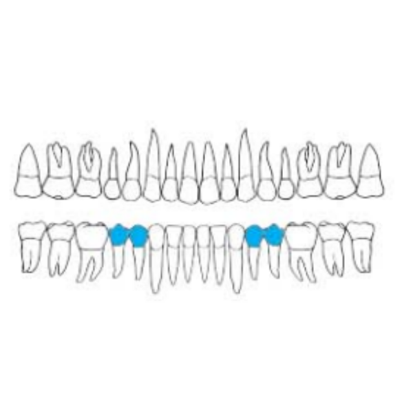 Perfect Alt Kök Premolar  Davyesi - Atravmatik Davye