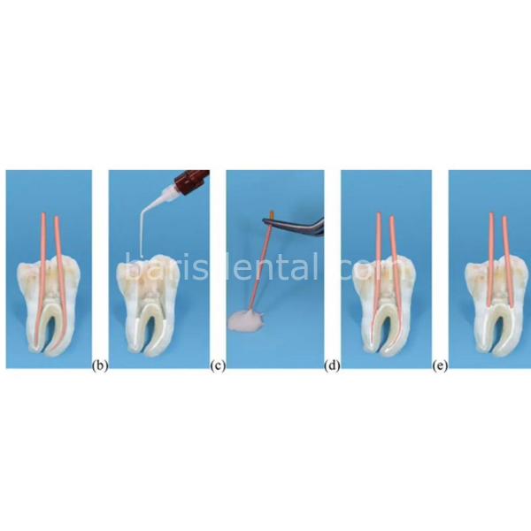 Meta Biomed Ceraseal  Bioseramik esaslı Kanal Dolgu Patı