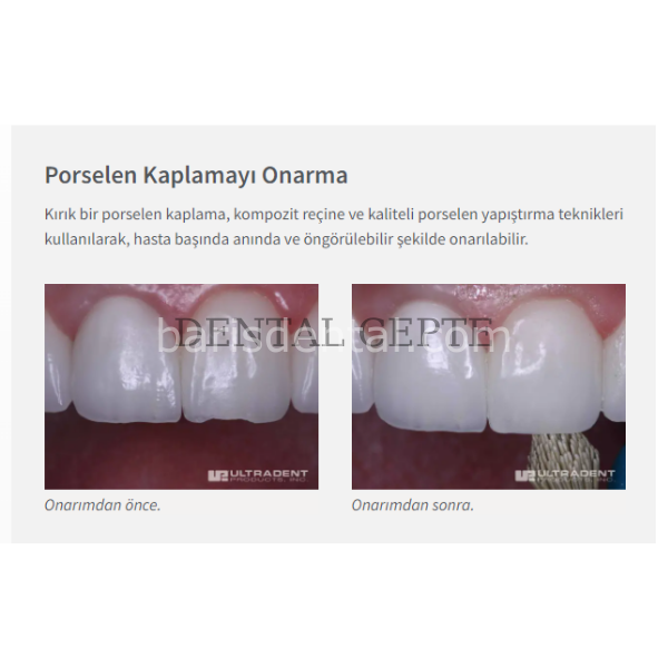 Ultradent Porselen Tamir Kiti